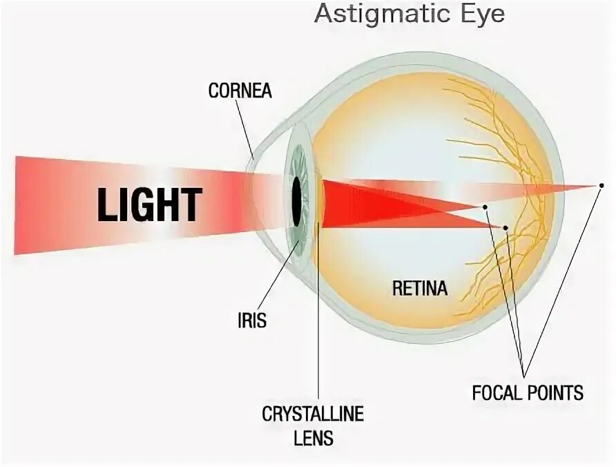 Crystal retinal