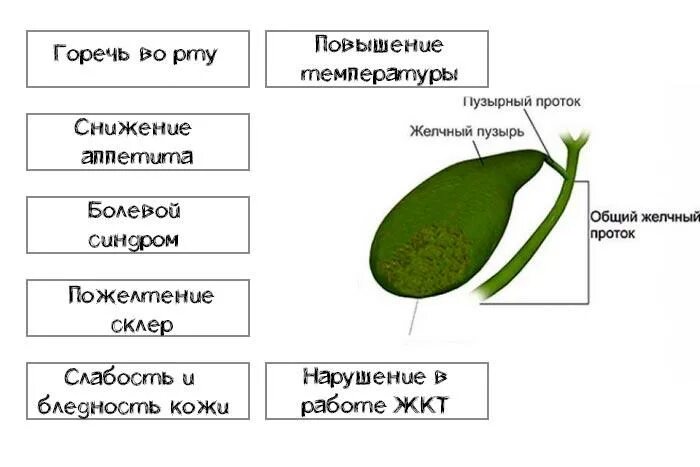 Схема образования камней в желчном пузыре. Песок в желчном пузыре симптомы. Удалили желчный пузырь горечь во рту