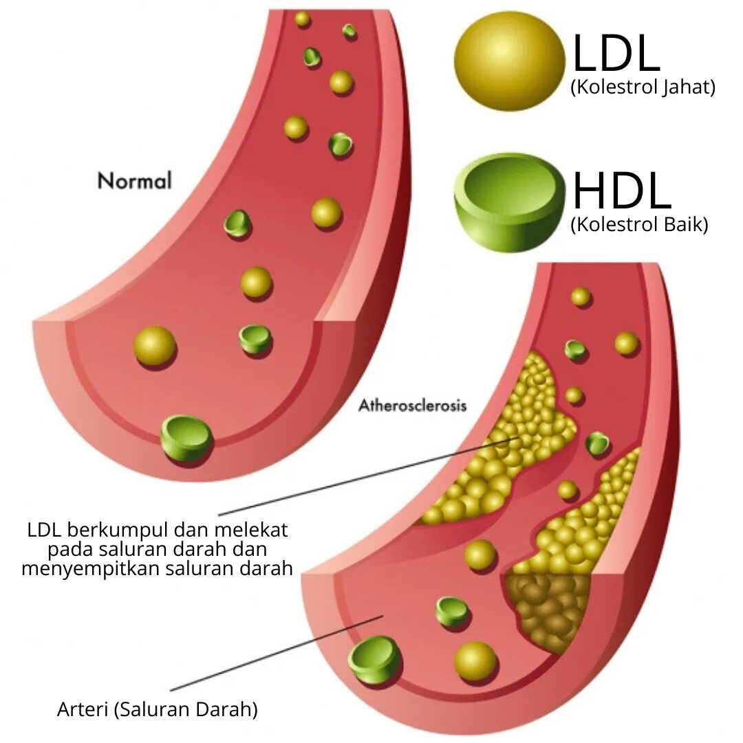 HDL cholesterol норма. LDL-холестерол. LDL И HDL холестерин норма. LDL холестерин что это.