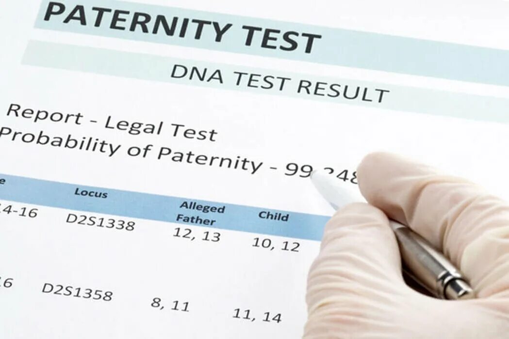 Дали днк тест. Paternity DNA Testing. Тест ДНК Эстетика. DNA Test Results. Test for Paternity.