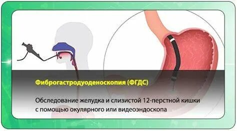 Фгдс и фкс