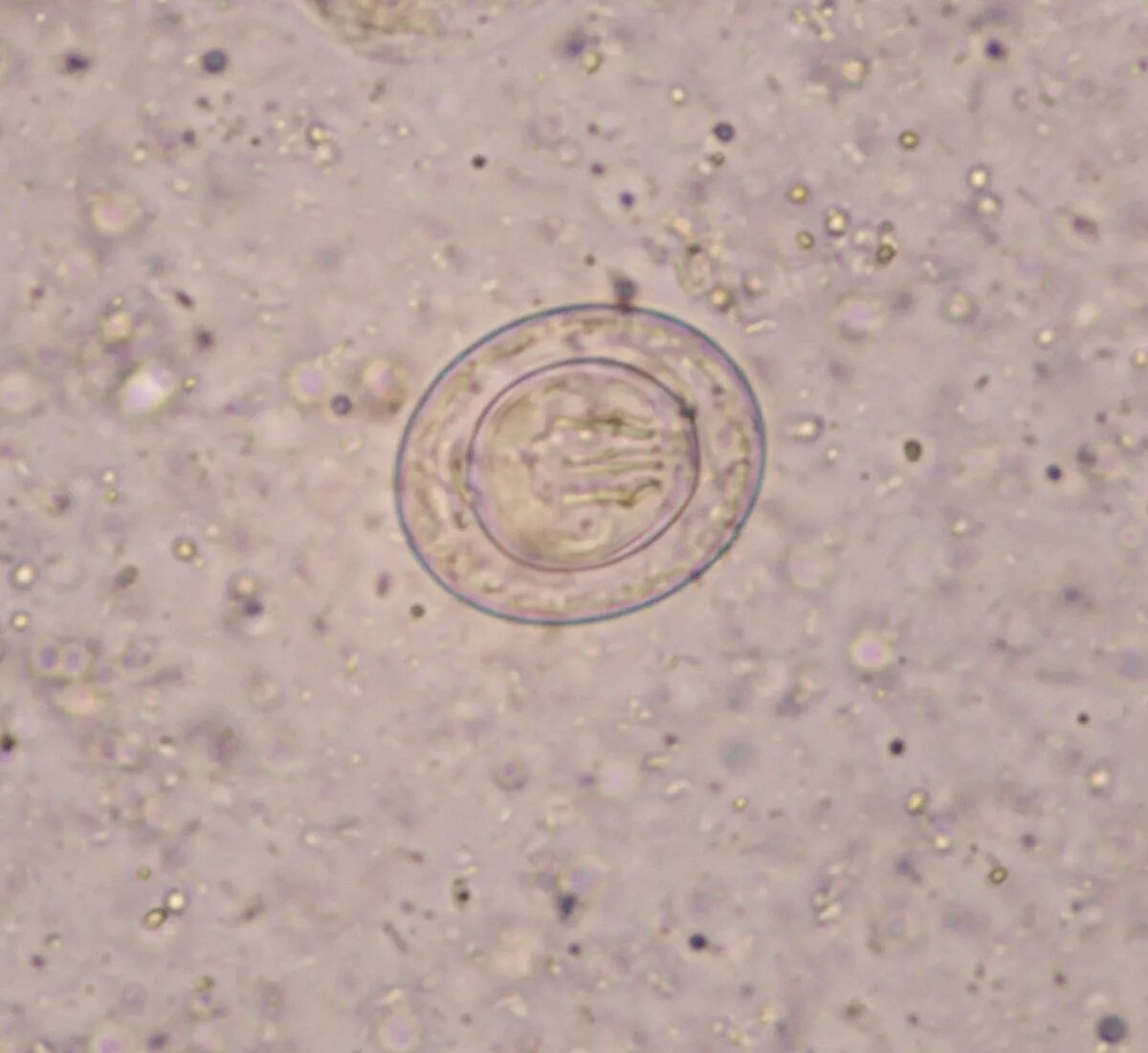 Крысиный цепень hymenolepis diminuta. Крысиный цепень. Крысиный цепень hymenolepis diminuta. Hymenolepis nana яйца. Болезнь крысиный цепень.