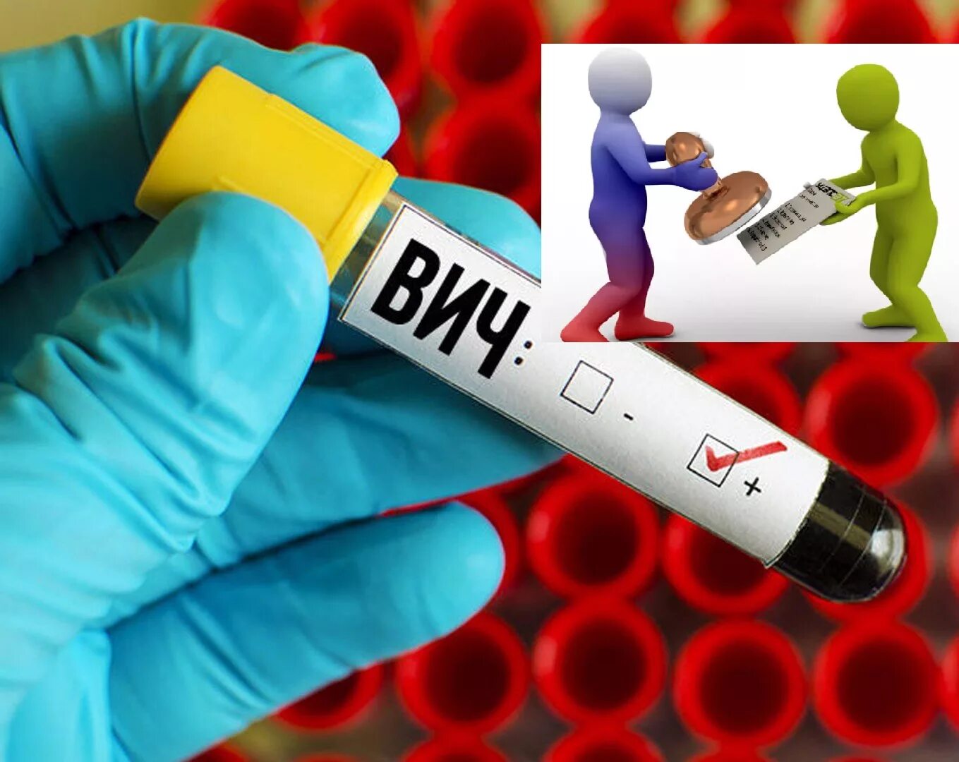 Выявление вич инфицированных. Вич. вич инфекция картинки. медицина вич. обследование на вич.