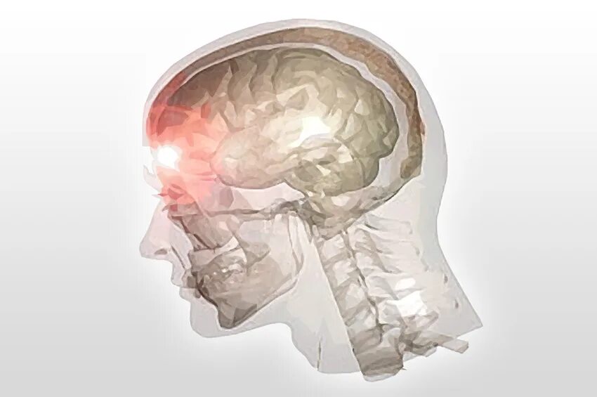Сотрясение черепа. Травматические повреждения черепа и головного мозга..