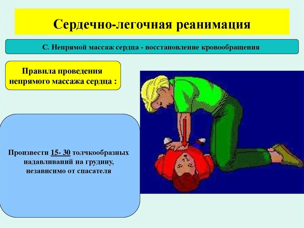 Этапы догоспитальной реанимации. Сердечно легочная реанимация 30 надавливаний. Сердечно-легочная реанимация (СЛР) таблица. Сердечно легочная реанимация непрямой массаж сердца. Сердечнотлегочная реанимация непрямой массаж сердца.