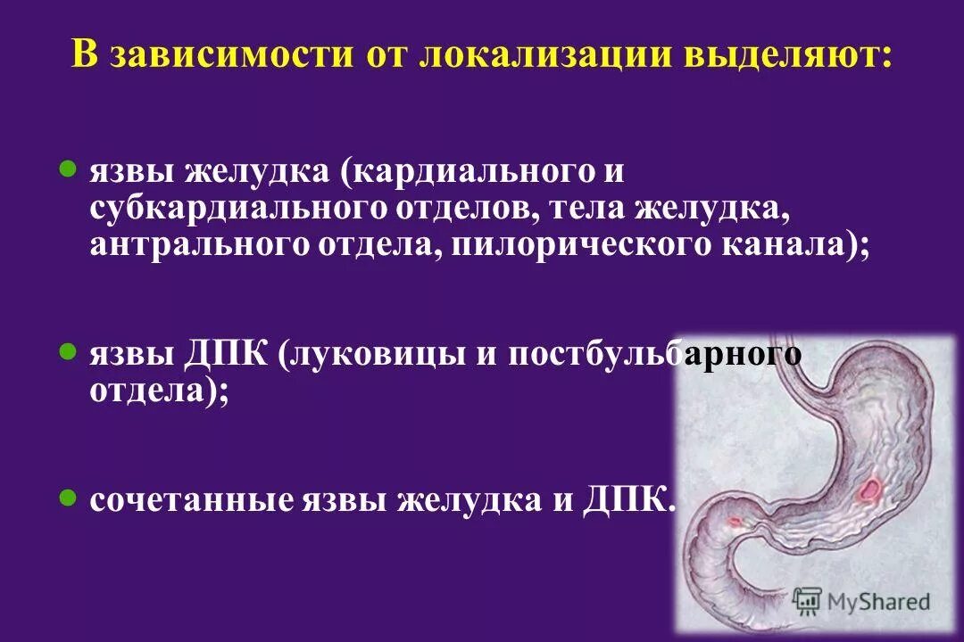заболевание желудок кишечного тракта. заболевание причины профилактика пищеварительная система. заболевания органов пищеварения гастрит. причины язвенной болезни. заболевания жкт патология.