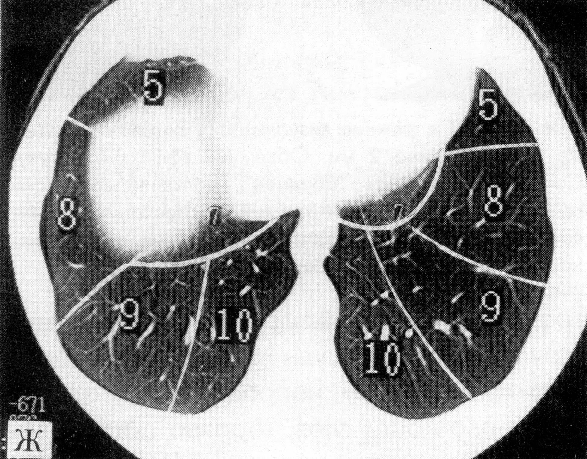 Доли легкого на кт. Сегменты легких кт Radiology 24. Сегментарное строение легких на кт. Сегменты ОГК кт. Сегменты лёгких на кт.