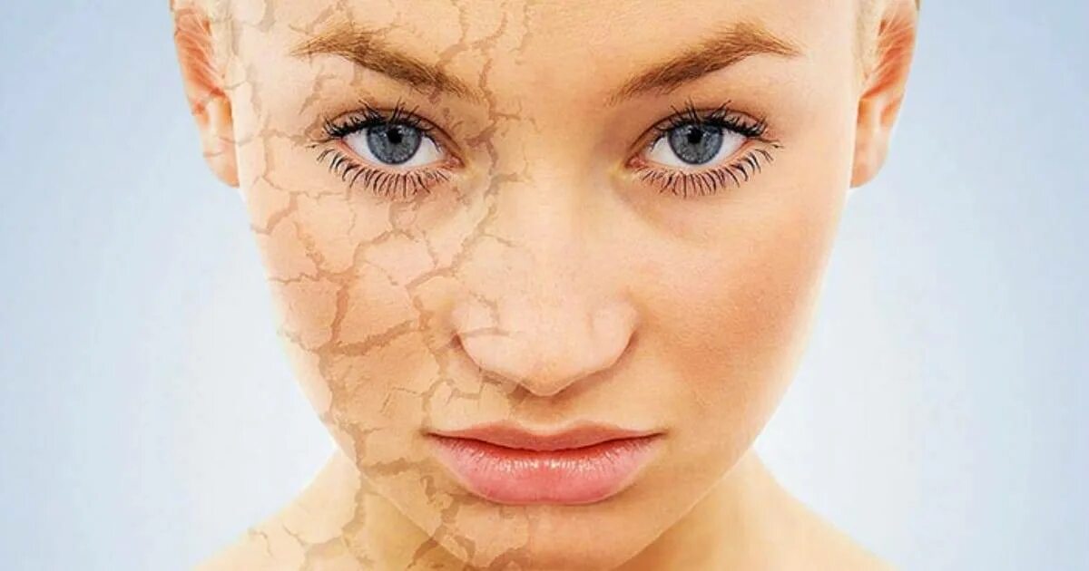 сухая кожа ног у женщины причины