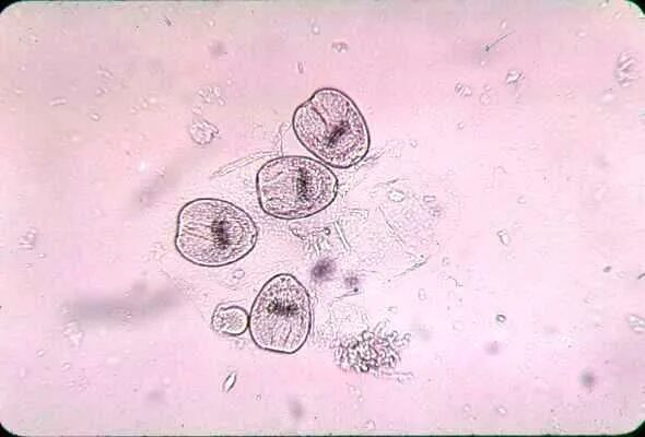 Эхинококкоз микроскопия. Сколексы эхинококка микроскопия. Шарко кале