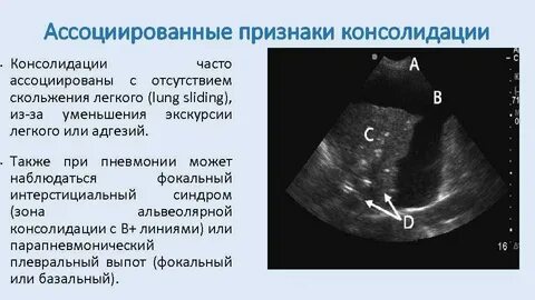 Узи бронхов