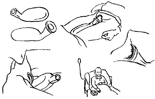 Подача судна алгоритм. Подача судна и мочеприемника тяжелобольному. Алгоритм подачи судна и мочеприёмника тяжелобольному пациенту. Подача судна и мочеприемника больному алгоритм. Схема подача судна и мочеприемника.