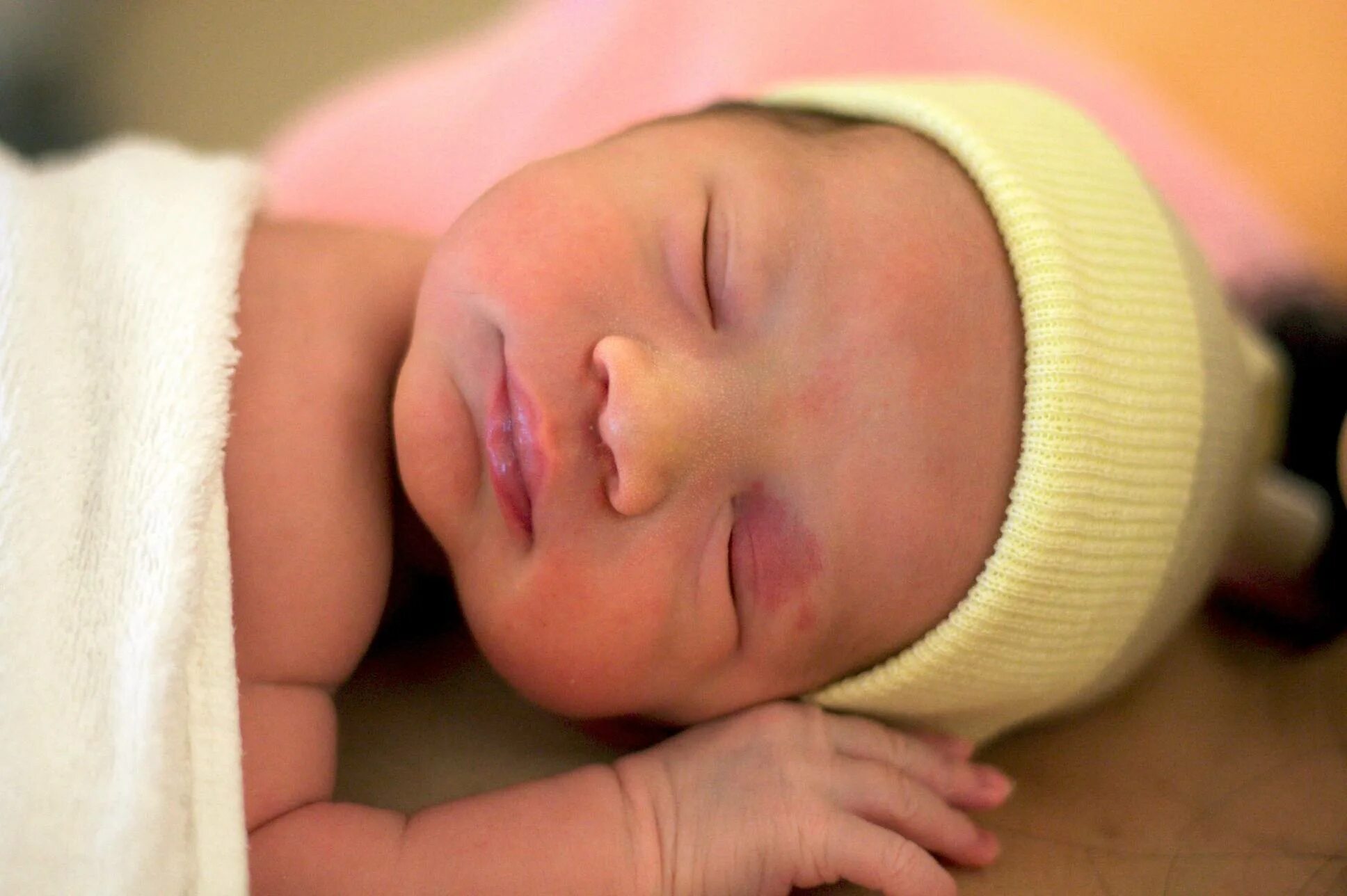 Желтушка у новорождённых. Родовая желтушка у новорожденных. Физиологическая желтушка у новорожденного. Желтушка у новорожденных 6. Ребенок желтуха почему