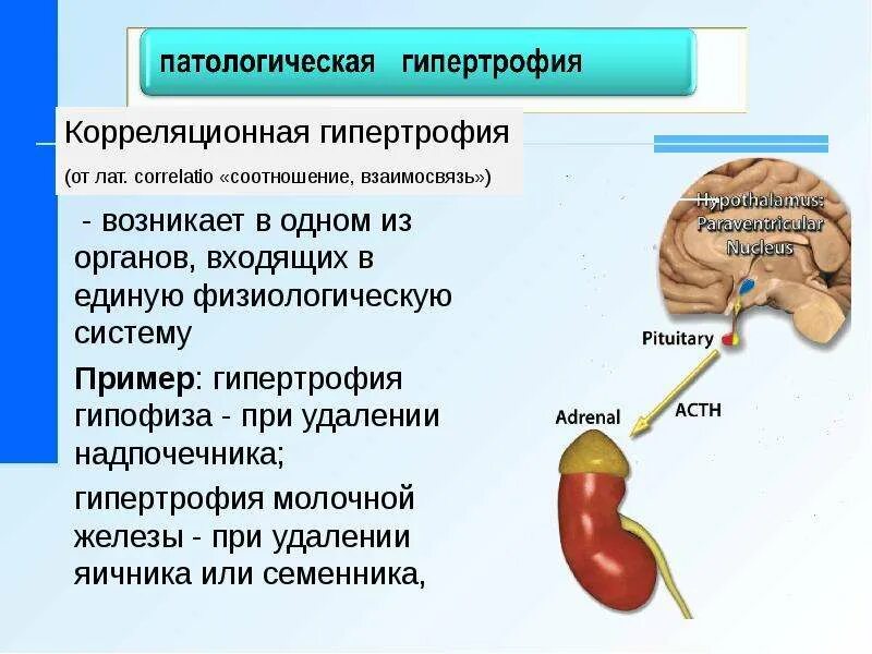 Гипертрофия что это. Гипертрофия надпочечников. Гипертрофия коры надпочечников. Гипотрофия надпочечников.