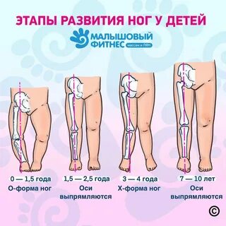 Ноги х в 2 года