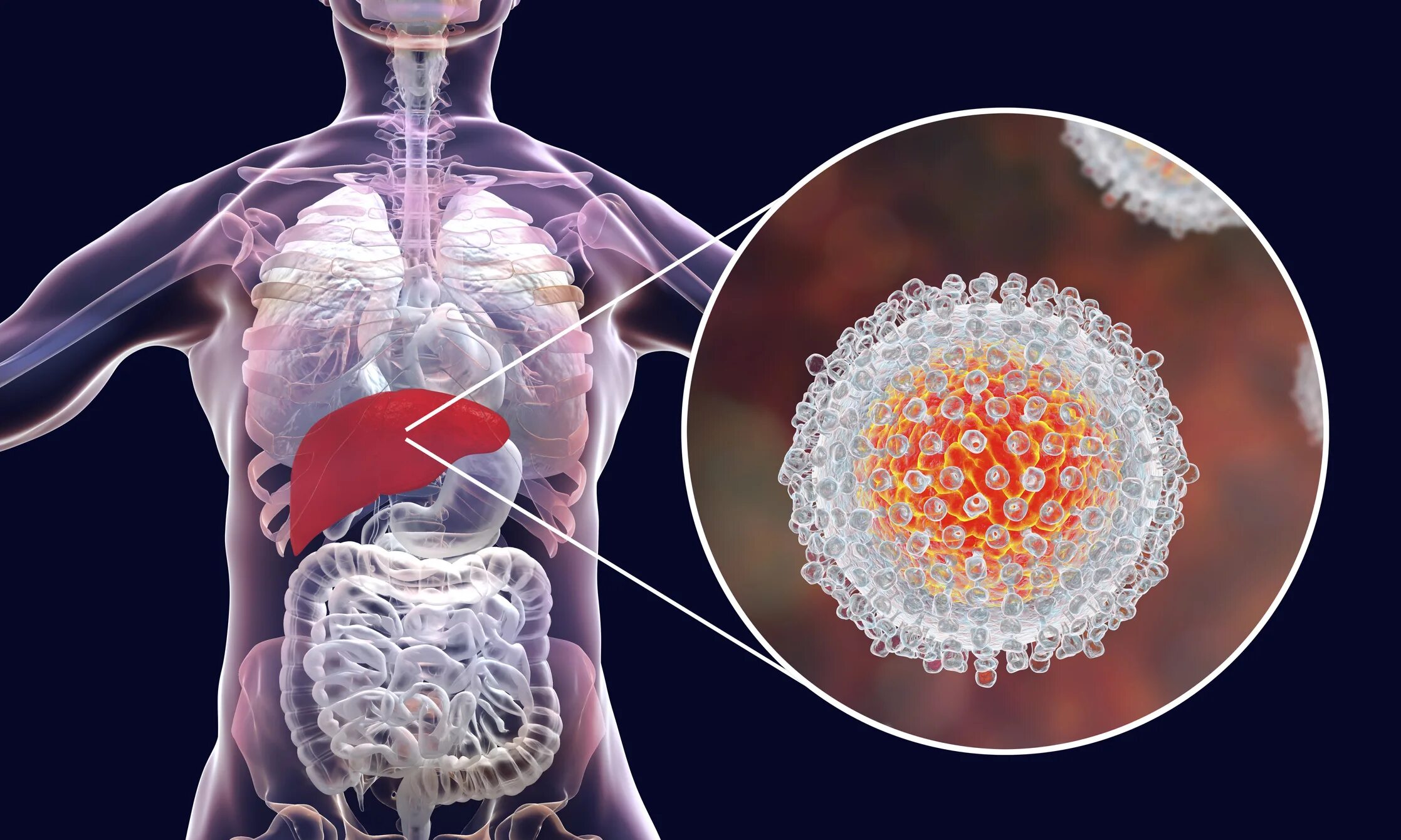 Гепатит c hcv