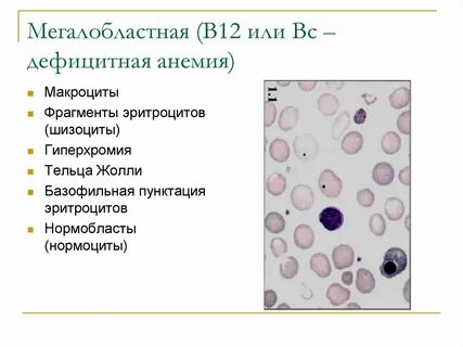 Макроциты