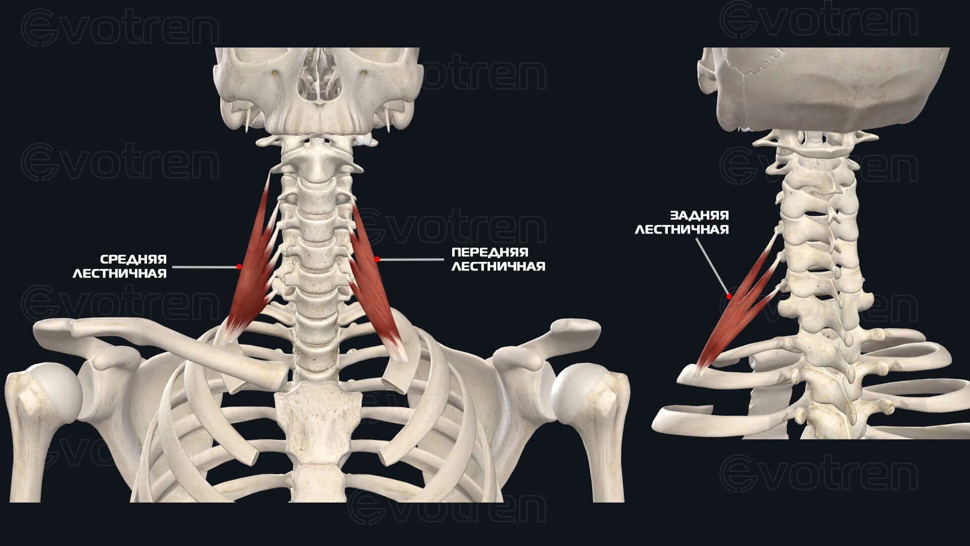 Лестничные мышцы шеи анатомия. Задняя лестничная мышца анатомия. Лестничные мышцы (латеральная группа). Средняя лестничная мышца анатомия.