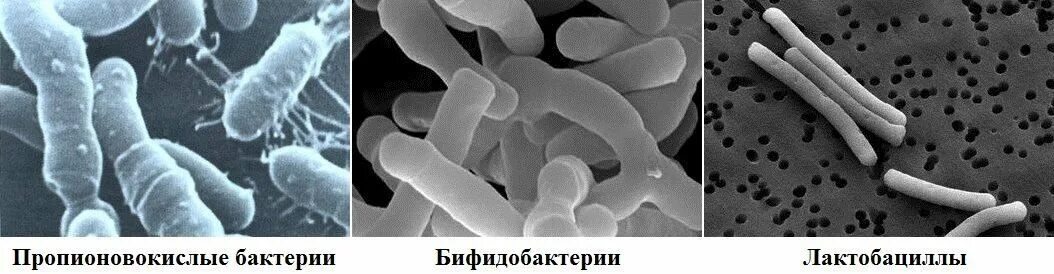 Бифидобактерии где. Пропионовокислые бактерии shermanii. Бифидо и пропионовокислые бактерии. Ферментация микроорганизмов пропионовокислые бактерии. Бактерии Propionibacterium.