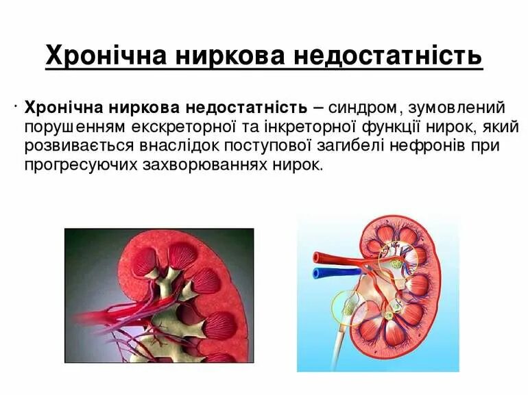 Азотемия почек вид почки. Преренальная азотемия. Азотемия при почечной патологии появляется вследствие. Ишемия почечной паренхимы обуславливает анурию азотемию. Почечная азотемия