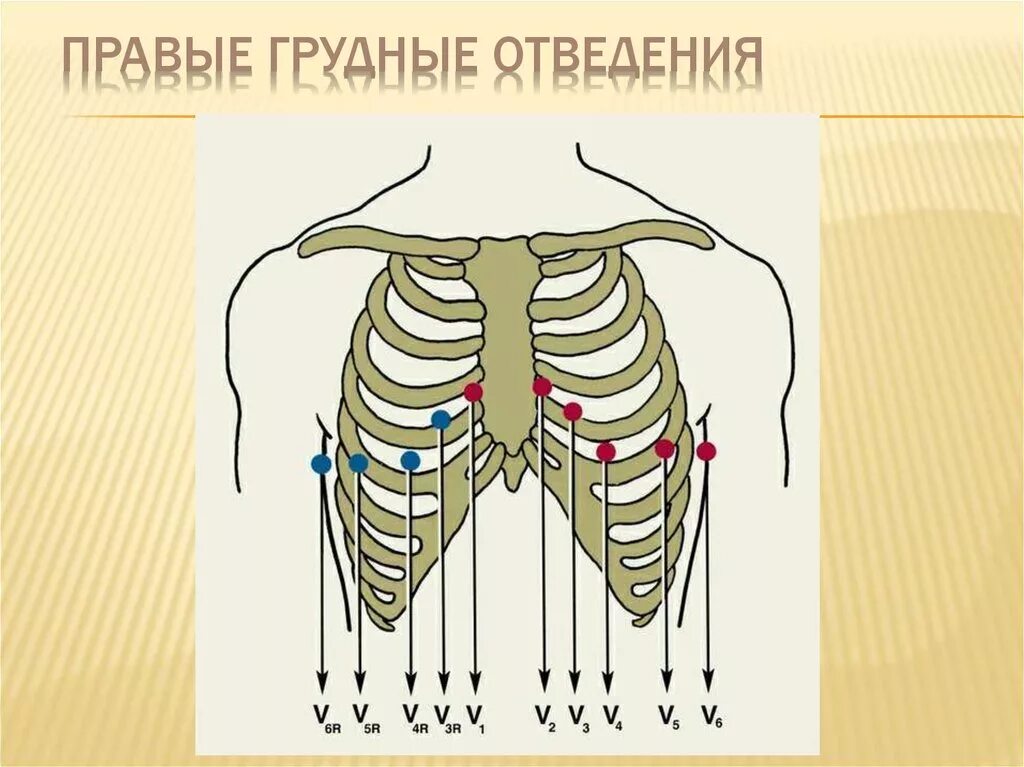 Правые грудные отведения