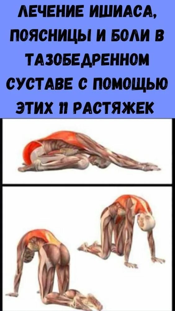 Воспаление седалищного нерва симптомы у мужчин. Растяжка седалищного нерва упражнения. Растянуть седалищный нерв. Растяжка при боли в седалищном нерве.