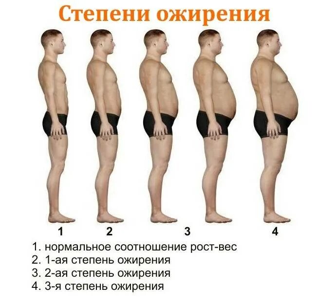 Ожирение первой степени у мужчин