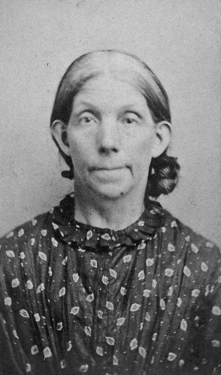 Люди больные шизофренией. Дэвид розенхан эксперимент. Взгляд психически больного. Лица душевнобольных. Люди с психическими расстройствами.