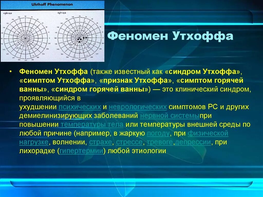 Феномен. Феномен Утхоффа. Симптом горячей ванны при рассеянном склерозе. Симптом Утхоффа. Феномен Утхоффа при рассеянном склерозе.