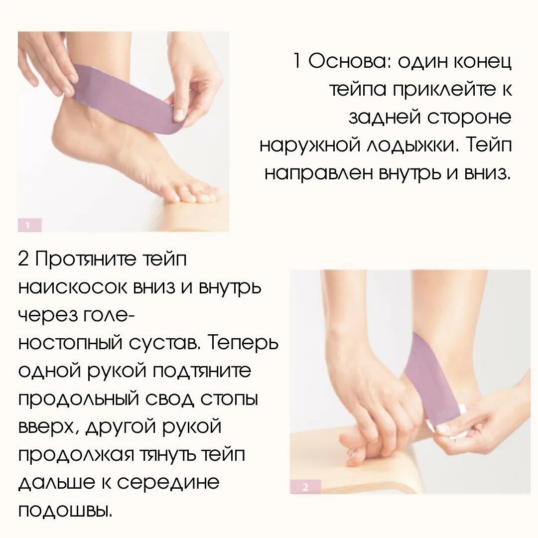 Тейпирование вальгусных. Тейпирование вальгусных