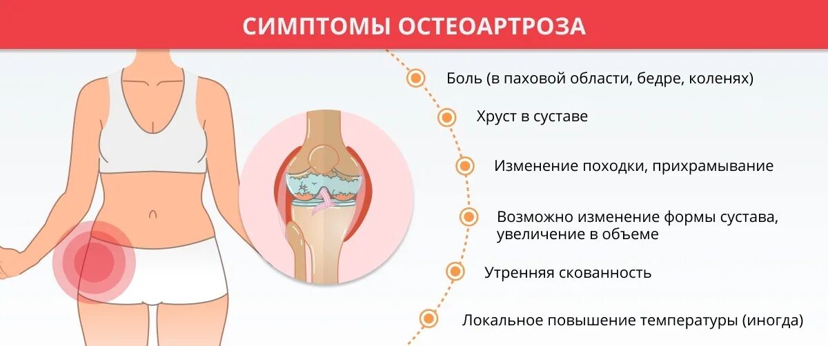 Тазобедренная боль у женщин причины и лечение