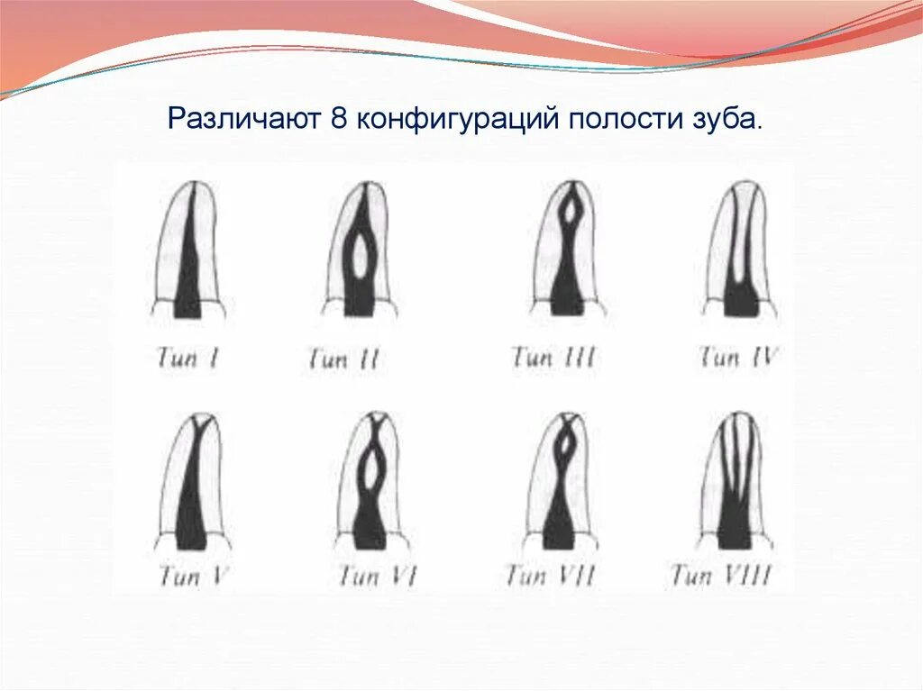 8 Конфигураций полости зуба. Классификация типов корневых каналов зубов.. Зубы корневые каналы топография. Анатомо-топографическое строение полостей и каналов зубов. Формы корневых каналов