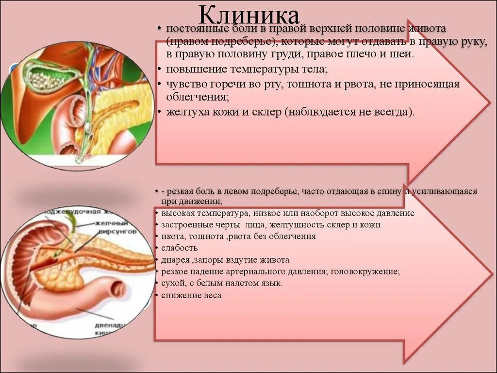 Боль в правом подреберье лечение холецистита. Острый холецистит клиника. Хронический холецистит клиника. Клиника холецистита и панкреатита. Клиника и диагностика острого холецистита.