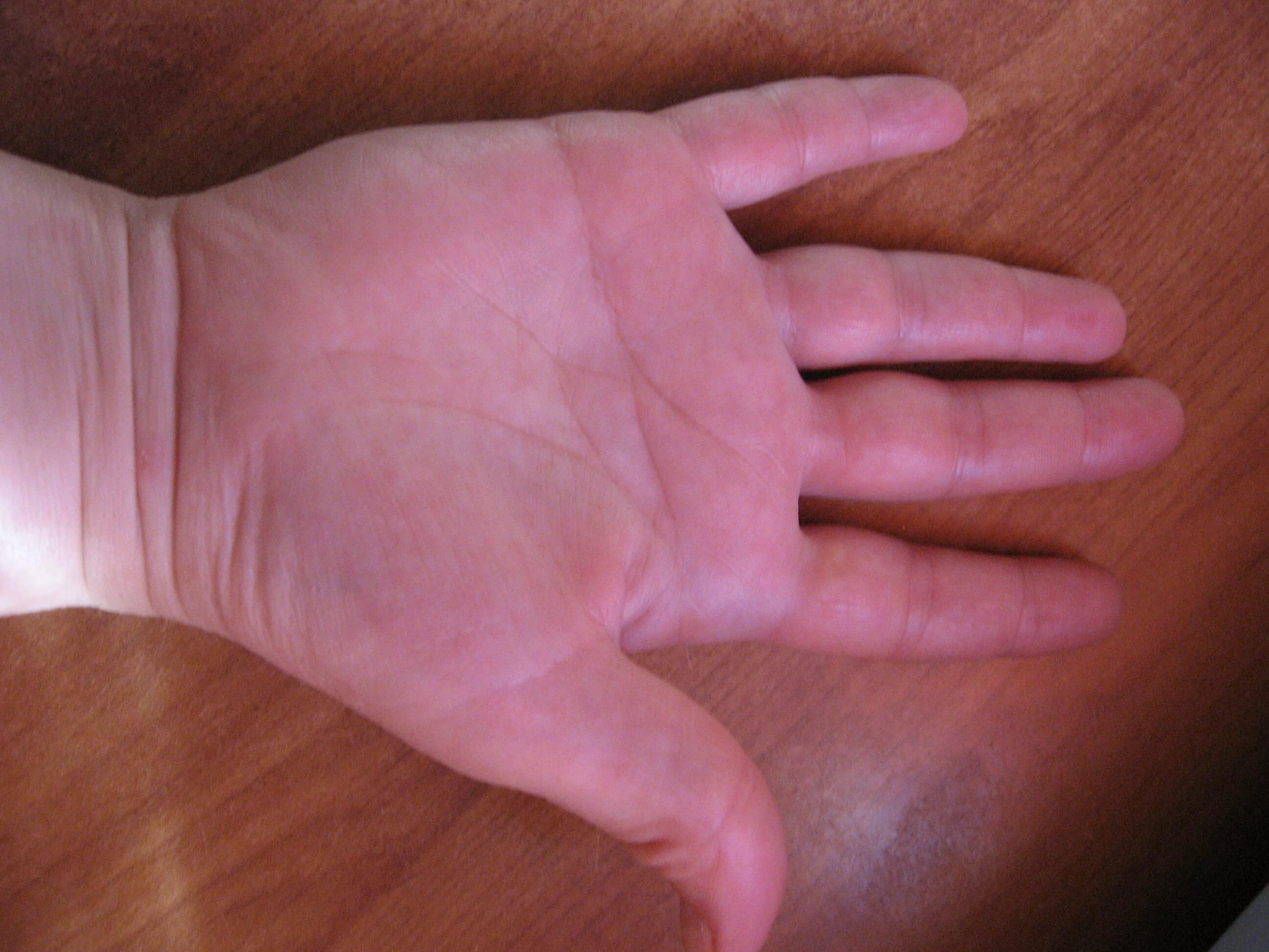 обезьянья линия. линия симиан синдром дауна. (обезьянья линия, линия симиан). обезьянья рука хиромантия. обезьянья линия.