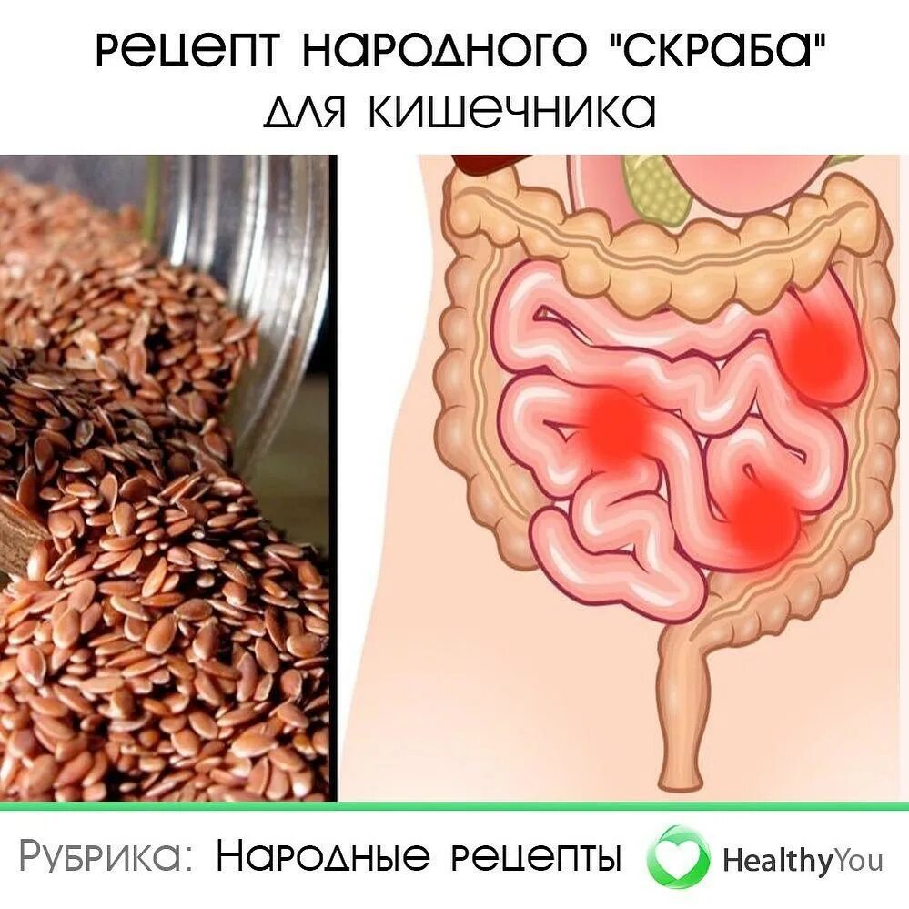 Как избавиться от камней в кишечнике