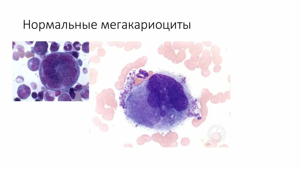 Мегакариоцит цитоплазма. Морфология мегакариоцитов. тромбоциты мегакариоциты. мегакариоцит строение. мегакариоциты функция.