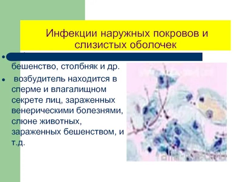 Заболевания наружного. Возбудители вирусных заболеваний наружных покровов. Инфекционные болезни наружных покровов. Возбудители бактериальных инфекций наружных покровов. Бактериальные инфекции наружных покровов пути передачи.