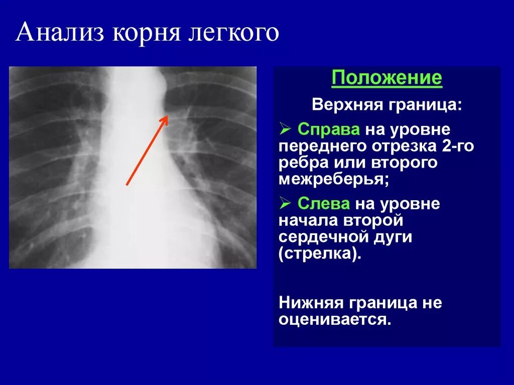 Прикорневой отдел легких