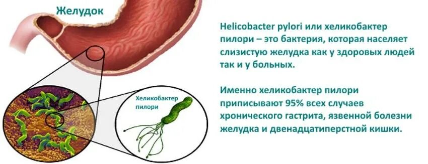 Причины появления хеликобактер в желудке