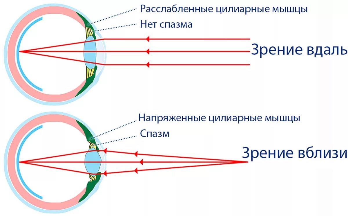 Аккомодация структуры. Схема аккомодации хрусталика. Аккомодационный аппарат глаза схема. Спазм аккомодации схема. Механизм аккомодации глаза схема.