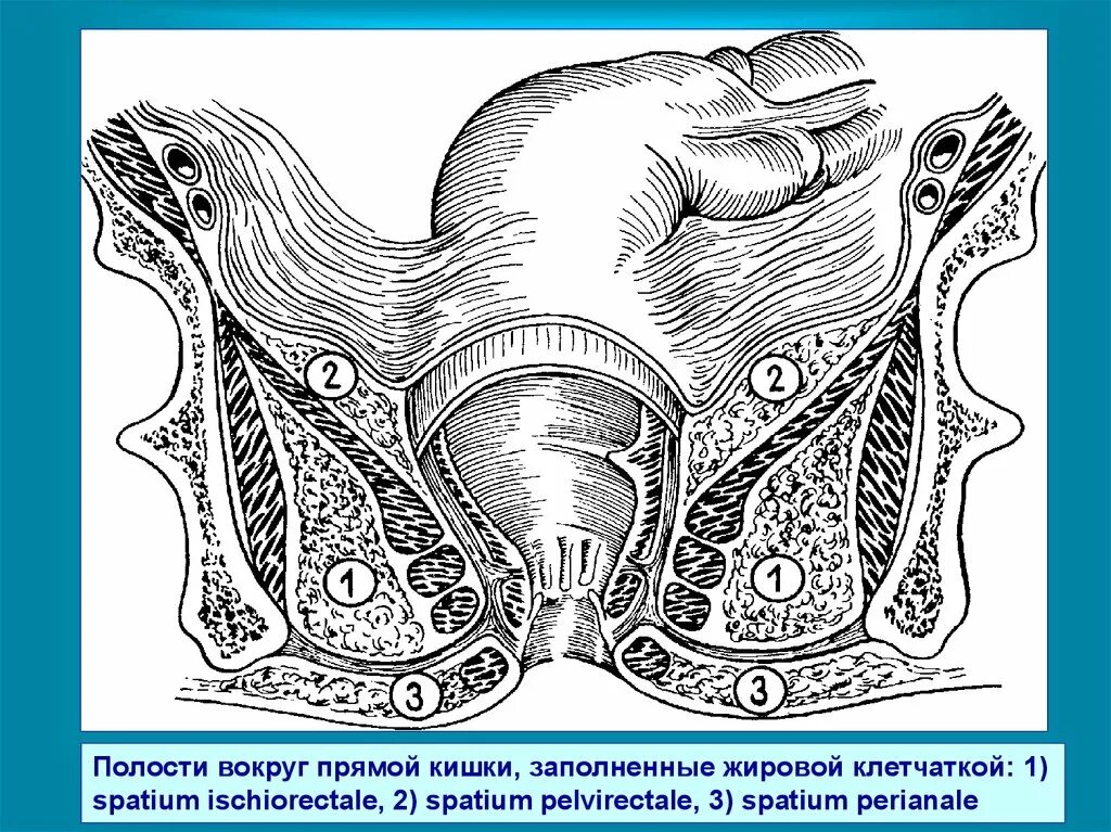 Хирург прямая кишка. Заболевания прямой кшик. хирургические заболевания прямой кишки. нависание прямой кишки.
