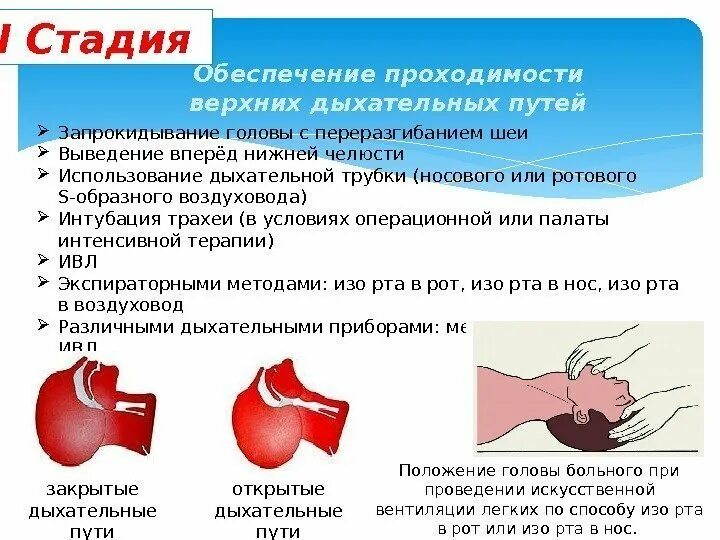 Обеспечение дыхательных путей алгоритм. Методы обеспечения проходимости дыхательных путей. приемы обеспечения проходимости дыхательных путей при реанимации. обеспечение проходимости верхних дыхательных путей. обеспечение проходимости верхних дыхательных путей при реанимации.