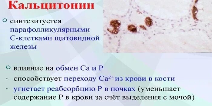 Исследование уровня кальцитонина в крови. Кальцитонин анализ щитовидной железы. Норма анализа кальцитонина в крови. Кальцитонин щитовидной железы норма у женщин. Кальцитонин 2 что значит