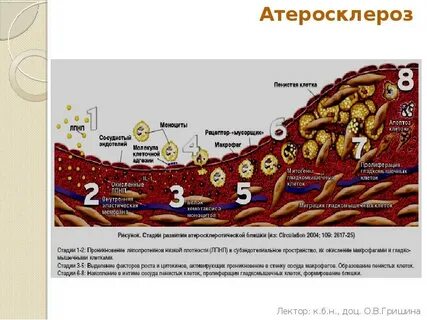 Атеросклероз биохимия