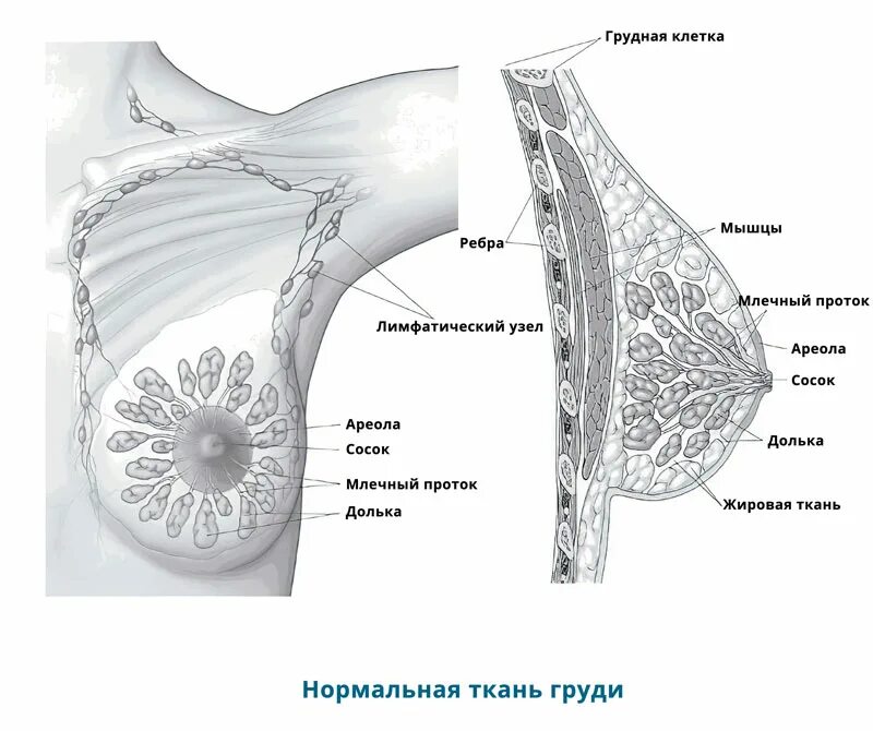 Доле груди. Дополнительная молочная железа. Дополнительные дольки молочных желез.