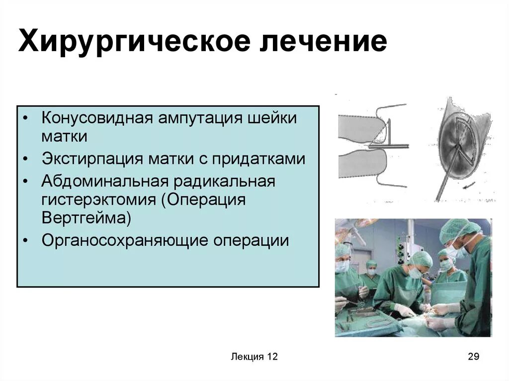 Гистерэктомия что это такое простыми словами. Экстирпация шейки матки. Высокая ампутация шейки матки. Конусовидная ампутация шейки матки.