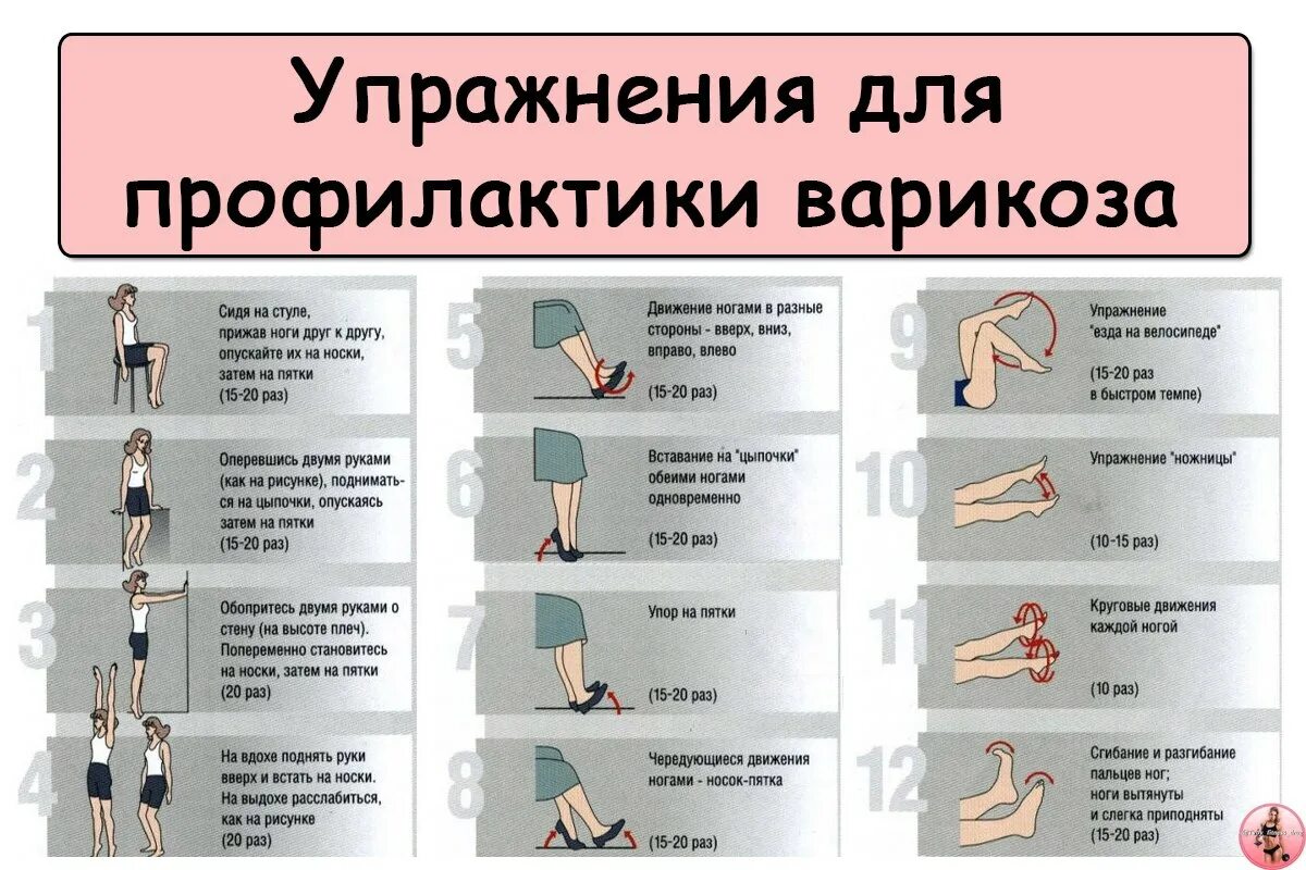 Гимнастика при варикозе вен на ногах. Лечебная гимнастика при варикозном расширении вен. ЛФК при ХВН нижних конечностей. ЛФК при болезни вен нижних конечностей.