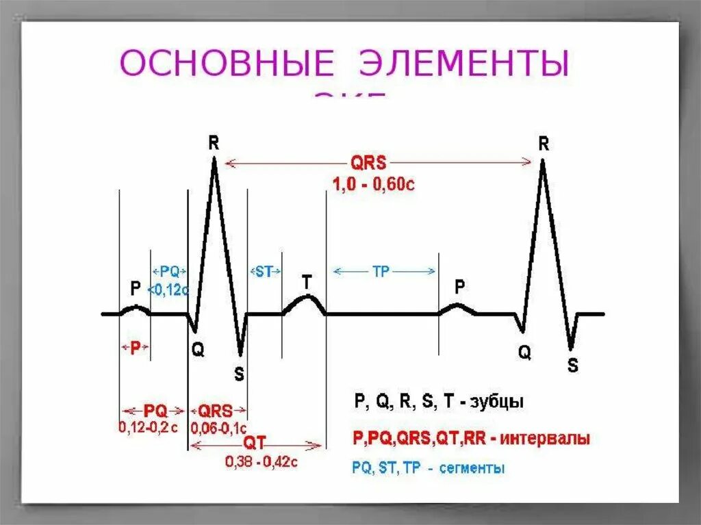 Qrs на экг что это. ЭКГ схема зубцов и интервалов. ЭКГ расшифровка зубцов и интервалов. Схема ЭКГ В норме. Комплекс QRS на ЭКГ норма.