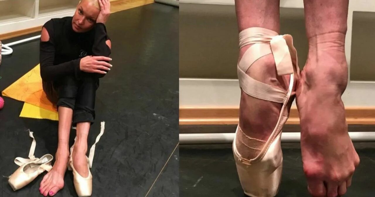 волочкова пуанты. ноги балерины волочковой без пуантов. стопы анастасии волочковой. волочкова пуанты. волочкова пуанты.