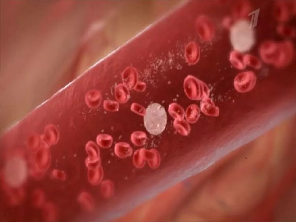 Видео фото кровь лейкоз. Кровь с признаками инфекции фото. Онкозаболевания крови