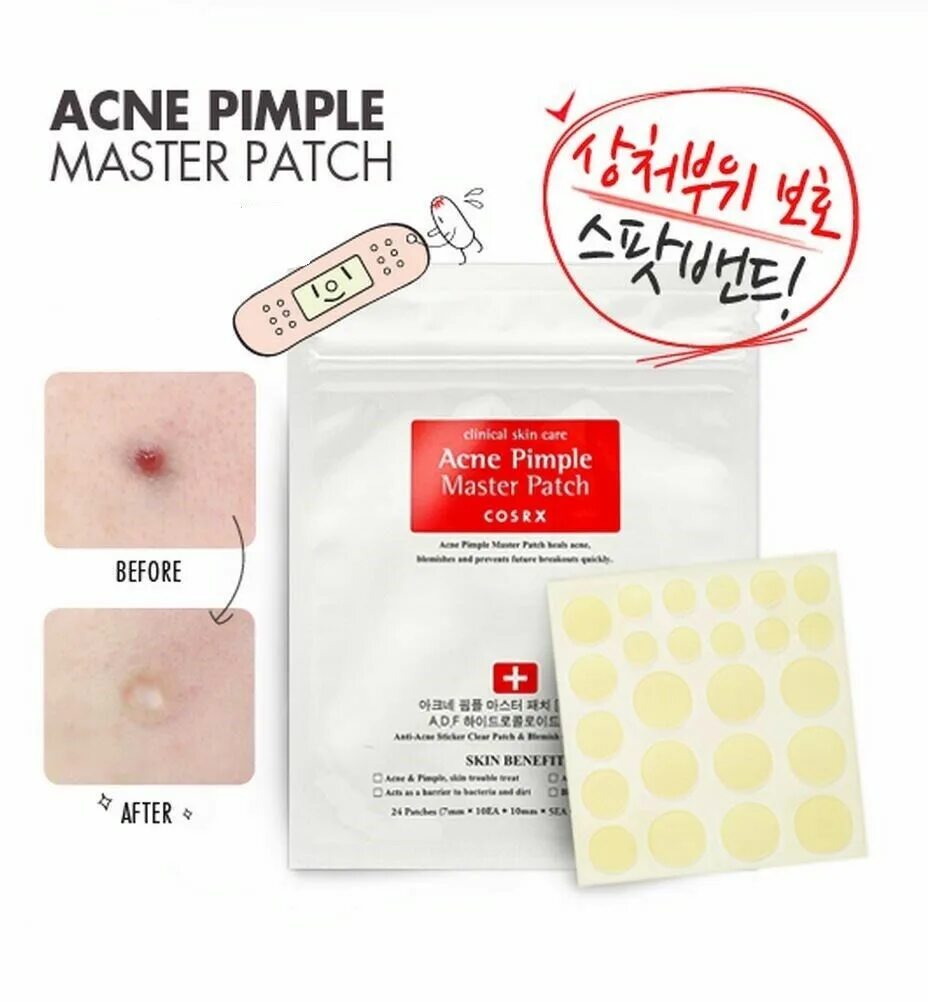 Acne pimple. Наклейки от прыщей cosrx acne pimple master patch. патч, пластырь против угрей cosrx acne pimple master patch 24шт. пластыри от прыщей cosrx acne pimple master patch (24 шт разных размеров).